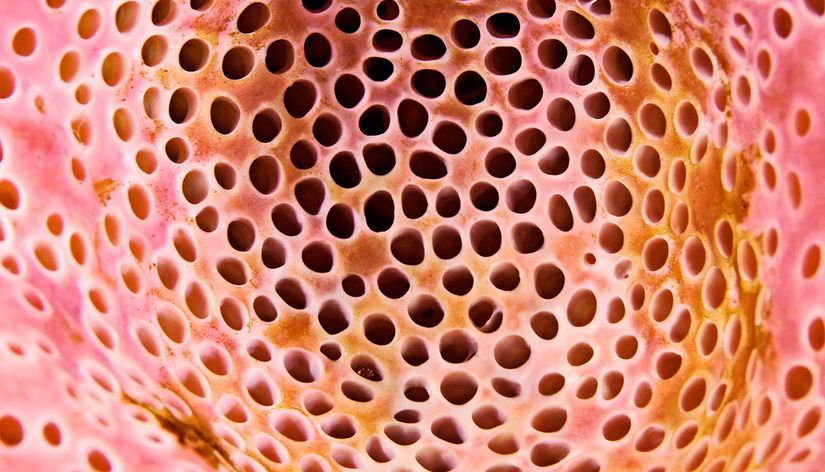 What Is Trypophobia? What You Need to Know About the Fear of Holes